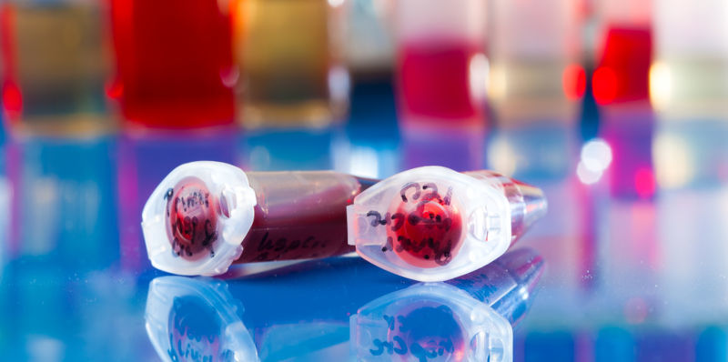 Sample of stem cells in the reaction tube